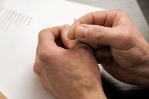 Acupuncture.Chinese medicine treatmen